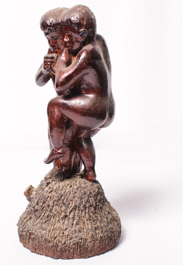 Сіамські близнюки