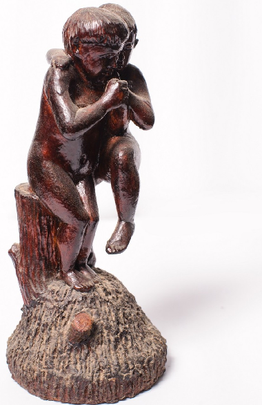 Сіамські близнюки