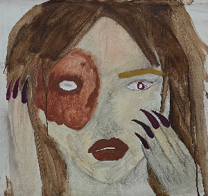 Моя рана загоїлася, і біль зник